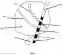 Fig. 09 - Closed loop computer-brain interface device