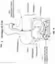 Fig. 08 - Device and implantation system for electrical stimulation of biological systems