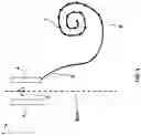 Fig. 02 - Cochlear implant system with optimized frame coding