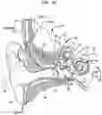 Fig. 02 - Noise reduction for implantable hearing prostheses