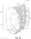 Fig. 07 - S1 NERVE ROOT STIMULATION SYSTEMS AND METHODS