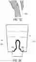 Fig. 09 - S1 NERVE ROOT STIMULATION SYSTEMS AND METHODS