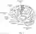 Fig. 02 - Methods for treating post-traumatic stress disorder in patients via renal neuromodulation