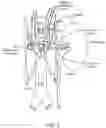 Fig. 04 - Methods for treating post-traumatic stress disorder in patients via renal neuromodulation