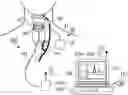 Fig. 01 - Control system for an implantable stimulating device for stimulating a vagus nerve