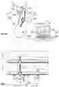 Fig. 05 - Control system for an implantable stimulating device for stimulating a vagus nerve