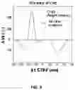 Fig. 05 - Bidirectional spike-timing-dependent brain network gain control
