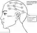 Fig. 01 - Therapeutic devices and methods to improve body functions