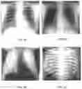 Fig. 09 - IMAGE-GUIDED RADIATION TREATMENT WITH IMAGING DATA USING IMAGING RADIATION AT DIFFERENT ENERGY LEVELS