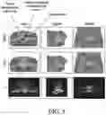 Fig. 06 - Portal dosimetry systems, devices, and methods