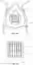 Fig. 22 - FACE MASK WITH REMOVABLE FILTER