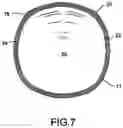 Fig. 08 - Baseball like training ball