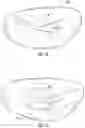 Fig. 10 - Faceplate of a golf club head