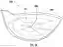 Fig. 17 - Faceplate of a golf club head