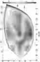 Fig. 18 - Faceplate of a golf club head