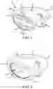 Fig. 02 - Variable thickness face plate for a golf club head