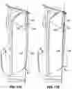 Fig. 114 - SNAP FIT GOLF BAG ASSEMBLY