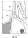 Fig. 30 - SNAP FIT GOLF BAG ASSEMBLY