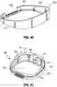 Fig. 48 - SNAP FIT GOLF BAG ASSEMBLY
