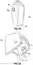 Fig. 53 - SNAP FIT GOLF BAG ASSEMBLY