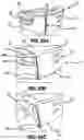 Fig. 56 - SNAP FIT GOLF BAG ASSEMBLY