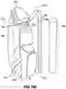 Fig. 96 - SNAP FIT GOLF BAG ASSEMBLY