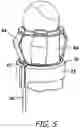 Fig. 06 - Portable baseball tee assembly with mechanical autoloading features