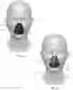 Fig. 05 - Face guard