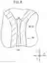Fig. 09 - Casting mold
