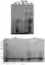 Fig. 05 - Method for separating and purifying recombinant human fibronectin from genetically engineered rice seed