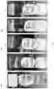 Fig. 08 - PEPTIDE COMPOUND WITH REPETITIVE SEQUENCES