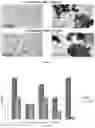 Fig. 05 - ENGINEERED OPSONIN FOR PATHOGEN DETECTION AND TREATMENT