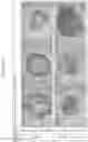 Fig. 04 - LUBRICIN-LOCALIZED CARTILAGE-LIKE TISSUE, METHOD FOR PRODUCING SAME AND COMPOSITION COMPRISING SAME FOR TREATING ARTICULAR CARTILAGE DAMAGE