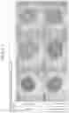 Fig. 07 - LUBRICIN-LOCALIZED CARTILAGE-LIKE TISSUE, METHOD FOR PRODUCING SAME AND COMPOSITION COMPRISING SAME FOR TREATING ARTICULAR CARTILAGE DAMAGE