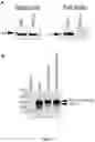 Fig. 07 - Angiotensin-converting enzyme 2 (ACE2) immunoadhesin microbody