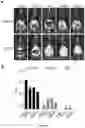 Fig. 23 - Angiotensin-converting enzyme 2 (ACE2) immunoadhesin microbody
