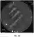 Fig. 49 - Stabilized CRISPR complexes