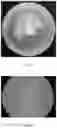 Fig. 02 - STRAIN PRODUCING ERGOTHIONEINE AND METHOD FOR SCREENING THE SAME