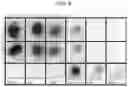 Fig. 07 - Methods of Depleting a Target Nucleic Acid in a Sample and Kits for Practicing the Same