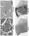 Fig. 17 - IDENTIFICATION OF HER2 MUTATIONS IN LUNG CANCER AND METHODS OF TREATMENT