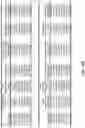 Fig. 69 - IDENTIFICATION OF HER2 MUTATIONS IN LUNG CANCER AND METHODS OF TREATMENT