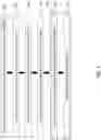 Fig. 02 - High entropy alloy structure and a method of preparing the same