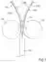 Fig. 02 - Method and apparatus for decorticating plant stalks