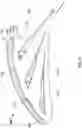 Fig. 09 - Compressor particle separator for gas turbine engine
