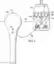 Fig. 06 - Hydrogen production and conveyance system