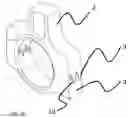 Fig. 07 - CONNECTING ROD AND PROCESS FOR ASSEMBLING