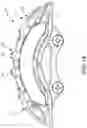 Fig. 10 - Pad return spring for a disc brake caliper body