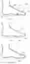 Fig. 07 - Apparatus and related methods of increasing foot propulsion