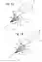 Fig. 02 - Steerable instrument comprising a detachable part