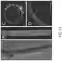 Fig. 22 - Systems and methods for OCT-guided treatment of a patient